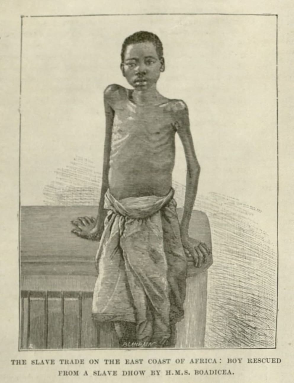 Boy Rescued from a Slave Dhow